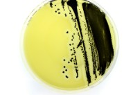 PLACA PREPARADA POTATO DEXTROSE AGAR 90 MM (20)