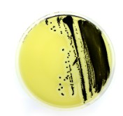 PLACA PREPARADA YEAST GLUCOSE CHLORAMPHEN AGAR(20