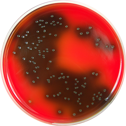 LISTERIA PALCAM AGAR (100)