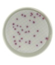 PLACA PREPARADA M-FC COLIFORM AGAR 60 MM (20)