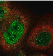 ANTI-KNL1 ANTIBODY PRODUCED IN RABBIT (100UL)