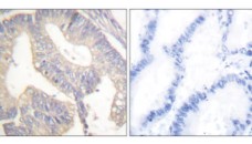 ANTI-GASTRIN ANTIBODY PRODUCED IN RABBIT (100 UG)