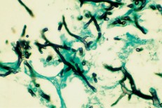 SILVER STAIN (MODIFIED GMS) KIT