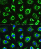 ANTI-HUMAN-ATG16L1 RABBIT POLYCLONAL 100 UL