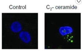 ANTI-HUMAN-LC3B RABBIT POLYCLONAL 100 UL