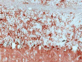 ANTICUERPO ANTI-GLUATAMINA SINTETASA (25 UL)