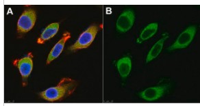 ANTI-BACE1 ANTIBODY, CLONE 3D5 (25 UG)