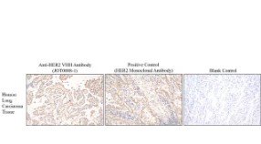 ALPACA ANTI-HER2 RECOMBINANT ANTIBODY (50U G)