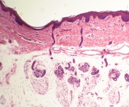 PREPARADO HISTOLOGICO PIEL HUMANA C/GLANDULAS 