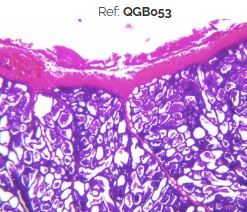 PREPARADO HISTOLOGICO MAMA SOLO EN ACTIVIDAD
