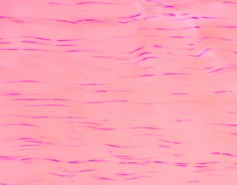 PREPARADO HISTOLOGICO TEJIDO CONJUNTIVO DENSO