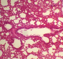 PREPARADO HISTOLOGICO PULMON SEC.