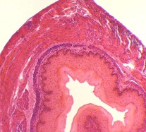 PREPARADO HISTOLOGICO ESOFAGO