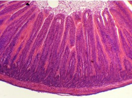 PREPARADO HISTOLOGICO YEYUNO