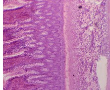 PREPARADO HISTOLOGICO INTESTINO GRUESO
