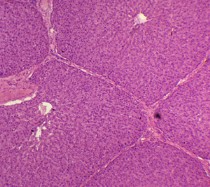 PREPARADO HISTOLOGICO HIGADO CERDO