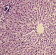 PREPARADO HISTOLOGICO HIGADO CONEJO