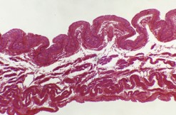 PREPARADO HISTOLOGICO VEJIGA URINARIA