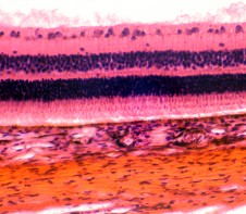 PREPARADO HISTOLOGICO GLOBULO OCULAR