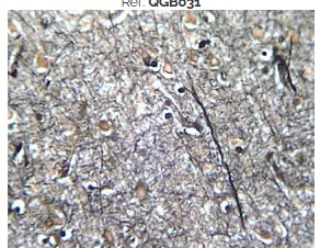 PREPARADO HISTOLOGICO CEREBRO HUMANO TINCION PLATA
