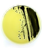 PLACA PREPARADA PSEUDOMONA CN AGAR (20)