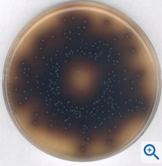 BILIS ESCULINA AGAR (500 G)