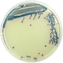 PLACA PREPARADA MANNITOL SALT AGAR (20) (CHAPMAN)